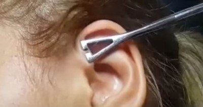 Faire un piercing anti-hélix