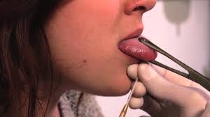 Faire un piercing langue venom ou double piercing langue