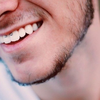  Piercing smiley / frein labial fer a cheval boules sur un homme