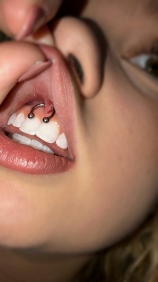  Détail d’un piercing smiley / frein labial circulaire boules