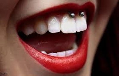  Piercing smiley / frein labial circulaire deux boules