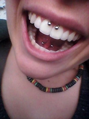  Piercing smiley / frein labial sur une femme avec un collier rasta
