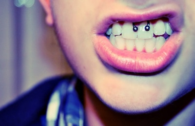  Piercing smiley / frein labial fer à cheval sur homme