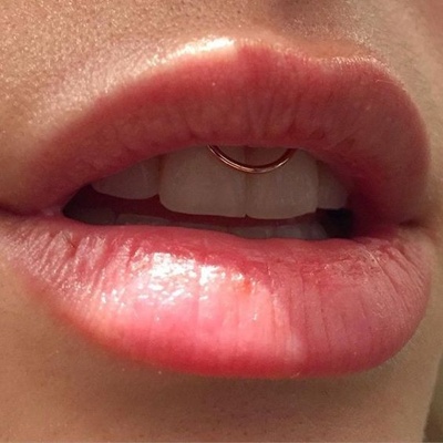  Piercing smiley / frein labial avec un anneau gold-ip rose