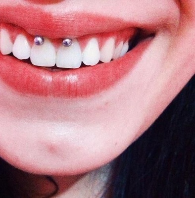  Piercing smiley / frein labial sur femme au beau sourire
