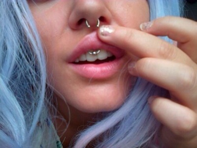  Piercing smiley / frein labial et septum sur femme avec des cheveux bleus