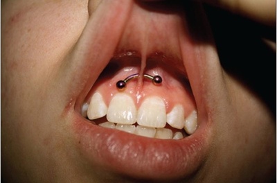  Piercing smiley / frein labial avec une banane en gros plan