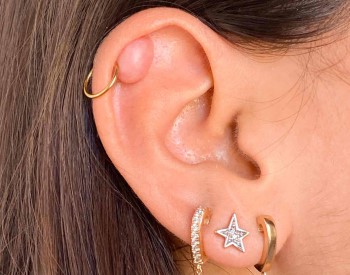 Chéloïde sur l’oreille -piercing
