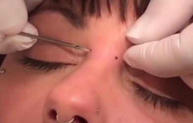 Se faire un piercing bridge