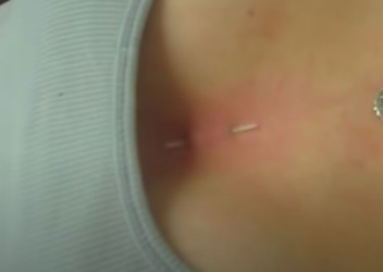 procédure de perçage du piercing cleavage, sternum B
