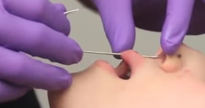 Se faire un piercing jestrum