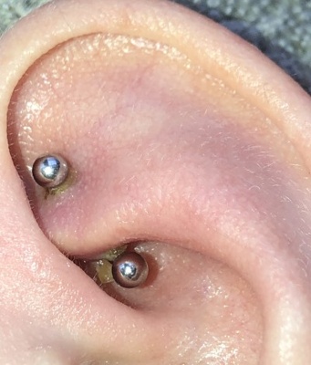 Lymphe et piercing