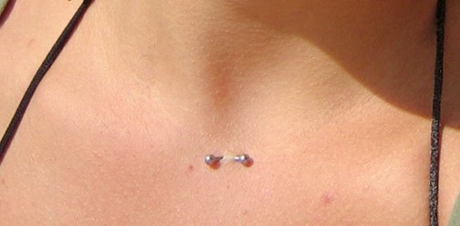Rejet et migration du piercing cleavage, sternum