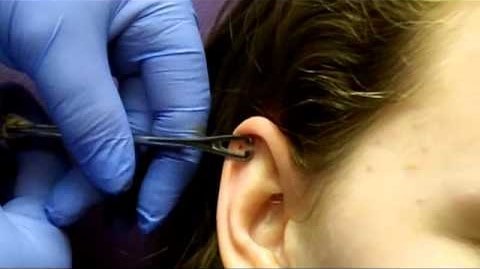 Se faire un piercing hélix